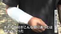 京都市の山中でクマに襲われ男性けが 「目の前に来てグワーッと口をあけて」当時の状況語る