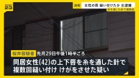 女性のくちびるを針と糸で縫ったか…49歳女逮捕　被害女性は店に駆け込み「助けてくれ」の紙見せる　女は被害者や他の人物と同居か　茨城・古河市