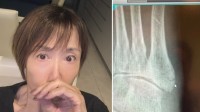 【 奈美悦子(75) 】絨毯に引っかかりテレビに激突　「右足にヒビが　情けない話です」「しばらく大人しくしています」
