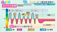 “大人虫歯”の原因『ちびだら習慣』って何？予防に効果的な「ガム」の噛み方を専門家が伝授【ひるおび】