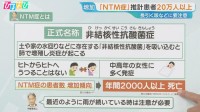 「咳が2週間以上続く」中高年の女性に多い『NTM症』感染経路や予防法は【ひるおび】
