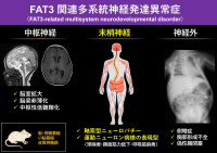 FAT3遺伝子変異が引き起こす新たな神経疾患「FAT3関連多系統神経発達異常症」を解明