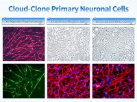 Cloud-Cloneが全系統の初代神経細胞ラインナップをグローバル展開