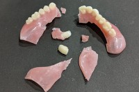災害や紛失に備える義歯データ保管サービス「入れ歯銀行」が全国展開