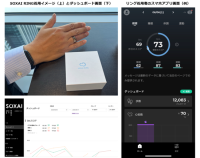 スマートリングを活用した術後患者の経過観察実証実験を開始