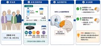 日常生活の軽い身体活動が高齢期の脳容積維持に寄与する可能性