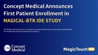 コンセプト・メディカル社、MAGICAL BTK IDE試験における最初の患者登録を発表、米国におけるPAD臨床プログラムを開始