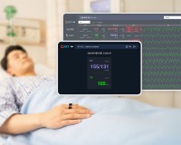 Sky Labs社、世界初の病棟向けリング型ウェアラブル血圧モニタリング・ソリューション「CART ON」発売