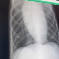 病気にかかった状態で保護された犬→命がけの過酷な治療をした結果…思わず泣けてくる『素敵な結末』に感動「涙が出た」「幸せに」と祝福の声