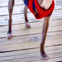 『3本足の犬なんていらない。』山に捨てられイノシシに襲われた犬→足を切断することになり…信じがたい『過去と現在』に反響「本当に強い子」